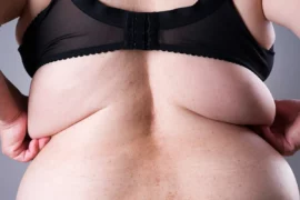 Übergewicht und seine Folgen: Ein tiefgehender Blick auf die globale Gesundheitskrise