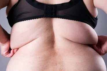 Übergewicht und seine Folgen: Ein tiefgehender Blick auf die globale Gesundheitskrise Übergewicht und seine Folgen: Ein tiefgehender Blick auf die globale Gesundheitskrise